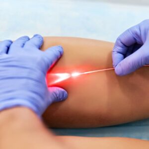 laser
