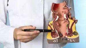 surgery