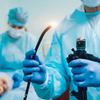 endoscopy at the hospital. doctor holding endoscope before gastroscopy